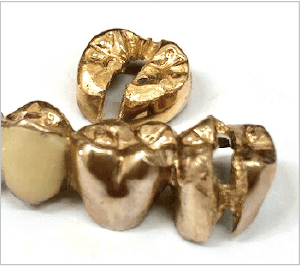 Gold teeth