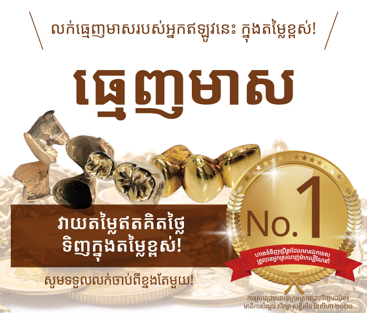 Jewel Cafe offers easy and speedy purchase at the store! No charge for evaluation and consultation.